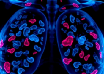 Blood Lipid Patterns Could Predict Which Breast Cancers Respond to Chemotherapy