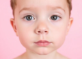 Skin Score Beats Blood Test for Gauging Severity of Childhood Mastocytosis, Study Finds