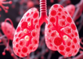 How Nutrient Availability Rewires Mitochondria and Cytoskeleton in 3D Lung Cancer Models