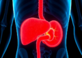 A Simple Staining Test Predicts Early Return of Colorectal Cancer After Liver Surgery