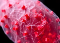 Inflammasome Biomarkers Could Predict Which Wounds Heal and Which Turn Chronic