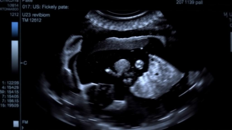 Vision Transformers Team Up With CNNs to Sharpen Blurry Ultrasound Images