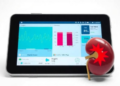 Digital Kidney Monitoring Passes the Clinical Test but Fails to Cut Costs, Danish Trial Finds