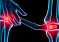 Antimicrobial Triclosan Linked to Joint-Damaging Stress in New Osteoarthritis Study