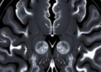 Sharper MRI Zoom Technique Reveals Tumor Edges but Shifts Key Cancer Numbers