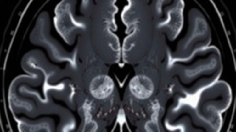 Sharper MRI Zoom Technique Reveals Tumor Edges but Shifts Key Cancer Numbers