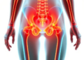 Parkinson's Doubles Hip Fracture Risk, Yet Osteoporosis Drugs Are No More Likely After Breaks