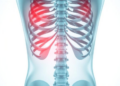 Jawbone Necrosis Affects One in Eight Breast Cancer Patients on Bone Drugs, Finnish Registry Finds