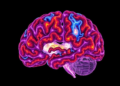 Massive Cell-by-Cell Map Reveals the Cerebellum's Hidden Role in Alzheimer's Disease