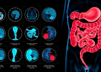 AI Model Fuses Scans, Blood Tests and Endoscopy Images to Gauge Crohn's Disease Activity