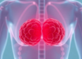 Tumor Twins: Living Lab-Grown Cancer Copies Paired With AI Could Transform Breast Cancer Treatment