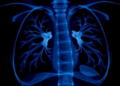 When Every Missed Breath Counts: AI Debate Over Detecting Neonatal Pneumothorax