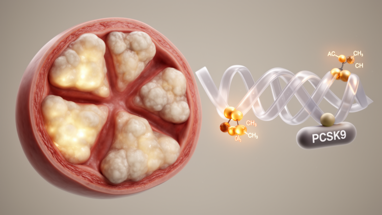 RNA acetylation enzyme NAT10 drives aortic valve calcification through PCSK9