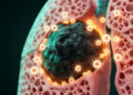 Hidden Immune Cells Offer New Hope Against the Deadliest Lung Cancer