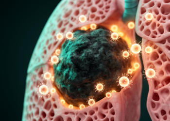 Hidden Immune Cells Offer New Hope Against the Deadliest Lung Cancer