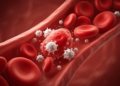 Hidden Immune Gene Variant May Explain Dangerous Blood Transfusion Reactions in Thalassemia Patients