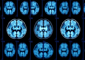 AI Reads Brain Scan Sequences to Spot Alzheimer's With New Hybrid Model