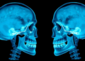AI Framework Aligns Skull X-Rays With Facial Photos for Orthodontics