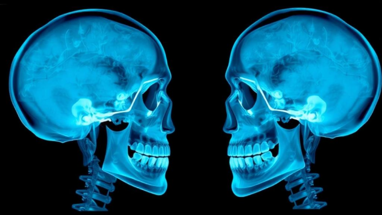 AI Framework Aligns Skull X-Rays With Facial Photos for Orthodontics