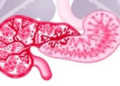 Rare Pancreatic Tumor With Dual Identity Harbors Never-Before-Seen KANK4-RAF1 Gene Fusion