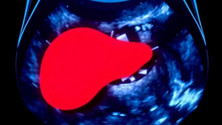Simple Blood-Based Scores Outperform Ultrasound Expectations in Spotting Fatty Liver Among Diabetes Patients