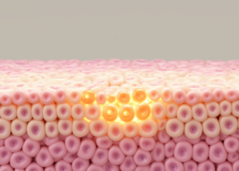 Early NOTCH1 Mutation Shields Esophageal Tissue from Turning Cancerous