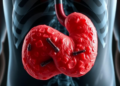 Deadly Fungal Invasion of Stomach and Spleen Followed Just Three Days of Steroids in Healthy Adult