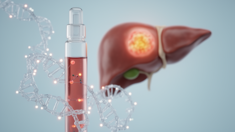 Cell-free DNA methylation markers emerge as promising liquid biopsy tools for detecting hepatitis B-related liver cancer