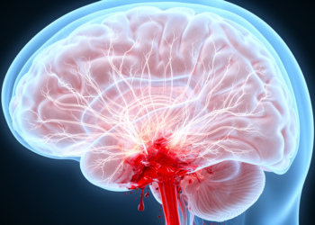A Runaway Nervous System May Drive Deadly Brain Swelling After Hemorrhagic Stroke