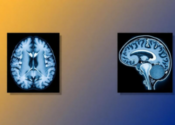 AI Workflow Turns Brain MRI Into CT-Like Images to Sharpen PET Scans