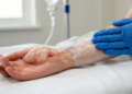 When CT Contrast Leaks: A 48-Hour Recovery From Blistering Extravastion...