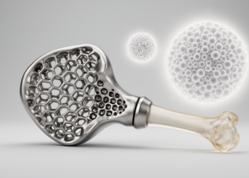 3D-Printed Metal Implants Get Smarter: New Review Maps the Path to Bone-Matching Prosthetics