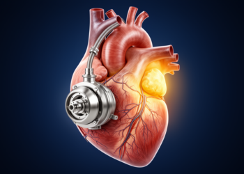 The Right Ventricle Emerges as the Achilles' Heel of Mechanical Heart Support