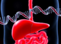 Genetic Study Reveals One-Way Causal Link Between Liver Autoimmune Disease and Inflammatory Bowel Disease