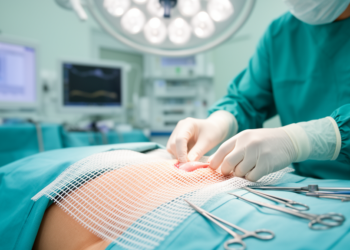 Where Surgeons Place Hernia Mesh May Shape the Risks of Every Future Abdominal Operation