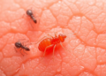 Tiny Skin Mites Found Far More Often in Malignant Tumors Than Benign Ones