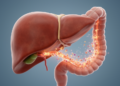 How the Gut-Liver Axis Prepares the Liver for Cancer Metastasis