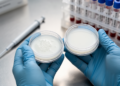 Latex immunoassays show bejel and syphilis share serological treatment responses