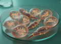 Gene Silencing by Methylation Marks the Aggressive Sarcomatoid Shift in Kidney Cancer