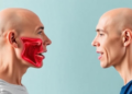 Team-Based Care Pathway Aims to Stop Muscle Loss in Nasopharyngeal Cancer Patients
