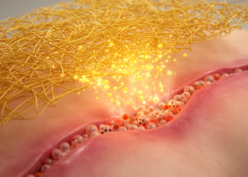 Turmeric-Powered Nanofiber Scaffold Rewires Infected Wounds to Heal Faster