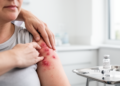 Biologic Therapy May Reshape Blood Clot Risk in Hidradenitis Suppurativa Over Time