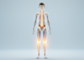 Hidden bone deficits in teens with congenital adrenal hyperplasia masked by fast-growing skeletons