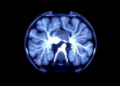 PET Scan Glucose Uptake Offers Clues to Immunotherapy Biomarker in Esophageal Cancer