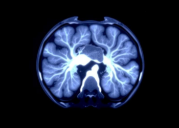 PET Scan Glucose Uptake Offers Clues to Immunotherapy Biomarker in Esophageal Cancer