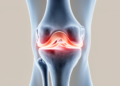 Shifting Loads Reveal How Knee Alignment Worsens Hidden Meniscus Tears While Walking