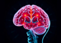 Adding Brain Radiotherapy to Targeted Drugs Extends Survival in Lung Cancer Patients with Brain Metastases