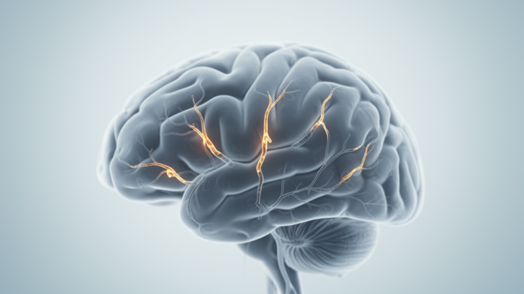 ApoE4 May Raise Risk of Cognitive Decline From Small Vessel Disease, Review Finds