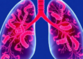 AI Model Links Calcium Pump Gene ATP2A2 to Immune Evasion in Lung Cancer