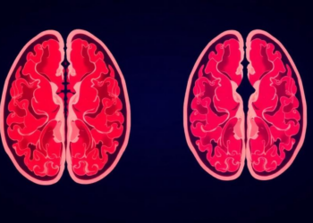 Simple Admission Data Struggle to Predict Stroke Deterioration After Clot Removal